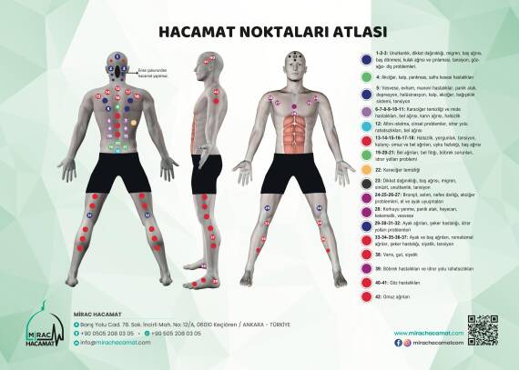 Atlas des points de ventouses - 2