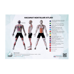 Atlas des points de ventouses - 6