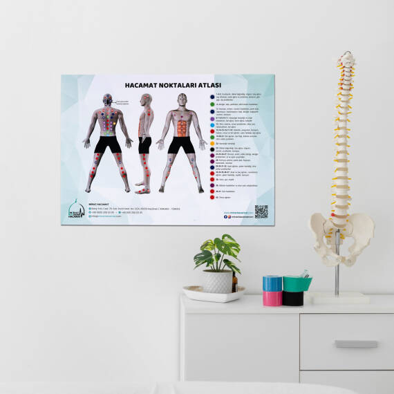 Atlas des points de ventouses - 4