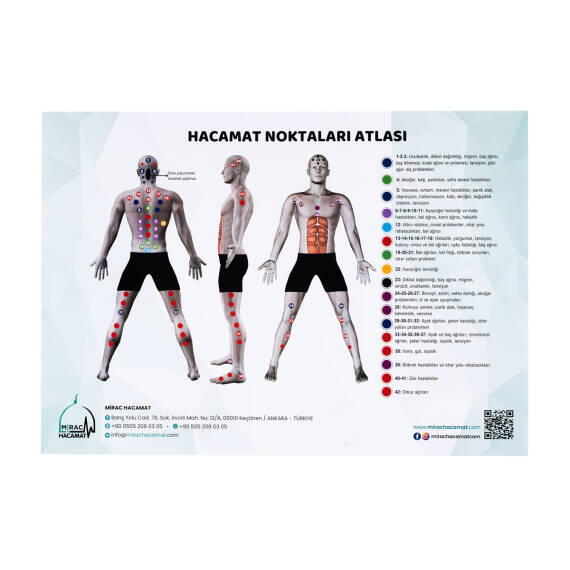 Atlas des points de ventouses - 1